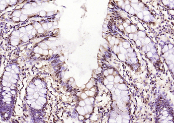 GAPDH Rabbit Polyclonal Antibody (Loading Control)