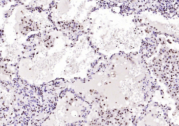 GAPDH Rabbit Polyclonal Antibody (Loading Control)