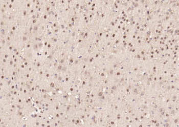 GAPDH Rabbit Polyclonal Antibody (Loading Control)