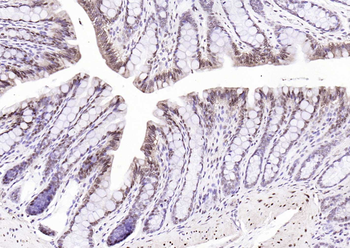 GAPDH Rabbit Polyclonal Antibody (Loading Control)