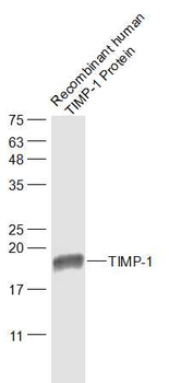 TIMP-1 Mouse Monoclonal Antibody