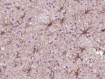 TIMP-1 Mouse Monoclonal Antibody