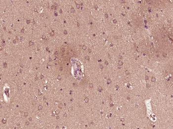 TIMP-1 Mouse Monoclonal Antibody