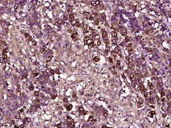TIMP-1 Mouse Monoclonal Antibody