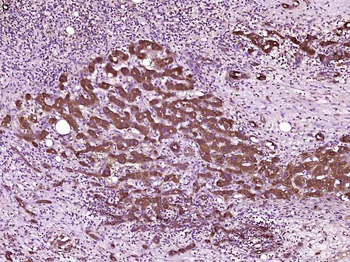 TIMP-1 Mouse Monoclonal Antibody