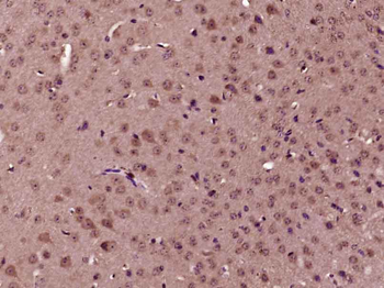 TIMP-1 Mouse Monoclonal Antibody
