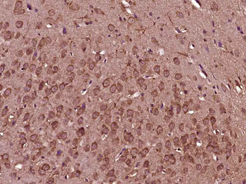 TIMP-1 Mouse Monoclonal Antibody