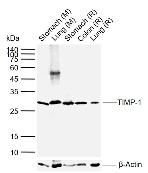 TIMP-1 Mouse Monoclonal Antibody