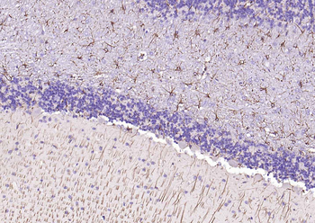 GFAP Rabbit Polyclonal Antibody