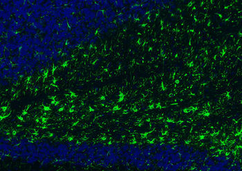 GFAP Rabbit Polyclonal Antibody