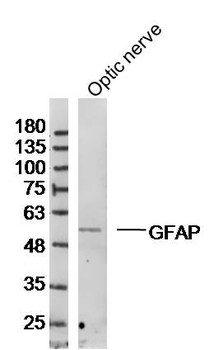 GFAP Rabbit Polyclonal Antibody