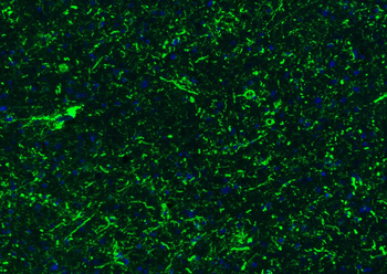 GFAP Rabbit Polyclonal Antibody