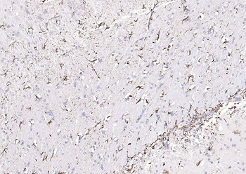 GFAP Rabbit Polyclonal Antibody
