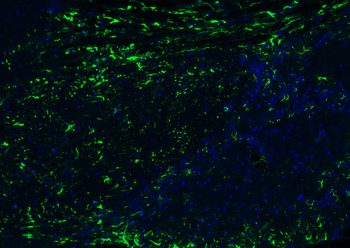 GFAP Rabbit Polyclonal Antibody