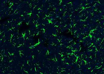 GFAP Rabbit Polyclonal Antibody