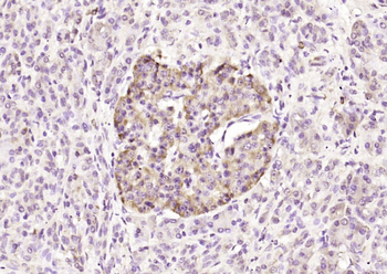 Bcl-2 Rabbit Polyclonal Antibody