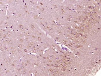 Bcl-2 Rabbit Polyclonal Antibody