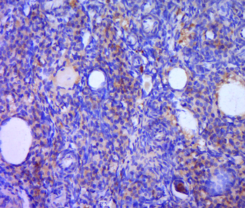 Bcl-2 Rabbit Polyclonal Antibody