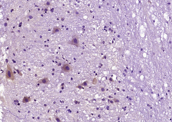 Bcl-2 Rabbit Polyclonal Antibody