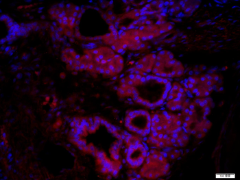 Bcl-2 Rabbit Polyclonal Antibody