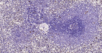 PCNA Mouse Monoclonal Antibody (Nuclear Loading Control)