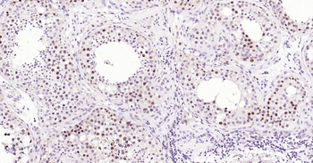 PCNA Mouse Monoclonal Antibody (Nuclear Loading Control)