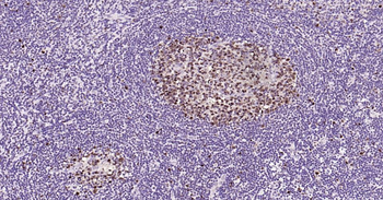 PCNA Mouse Monoclonal Antibody (Nuclear Loading Control)