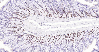 PCNA Mouse Monoclonal Antibody (Nuclear Loading Control)