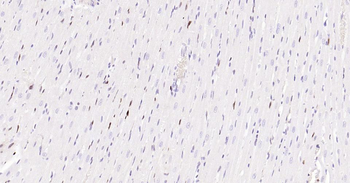 PCNA Mouse Monoclonal Antibody (Nuclear Loading Control)