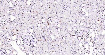 PCNA Mouse Monoclonal Antibody (Nuclear Loading Control)