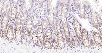PCNA Mouse Monoclonal Antibody (Nuclear Loading Control)
