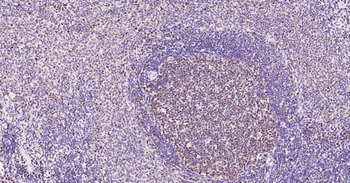 PCNA Mouse Monoclonal Antibody (Nuclear Loading Control)
