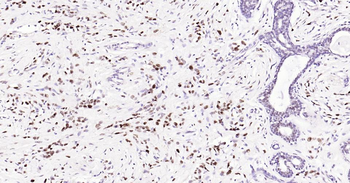 PCNA Mouse Monoclonal Antibody (Nuclear Loading Control)