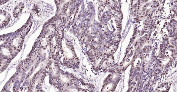 PCNA Mouse Monoclonal Antibody (Nuclear Loading Control)