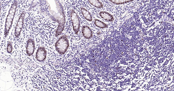 PCNA Mouse Monoclonal Antibody (Nuclear Loading Control)