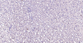 PCNA Mouse Monoclonal Antibody (Nuclear Loading Control)