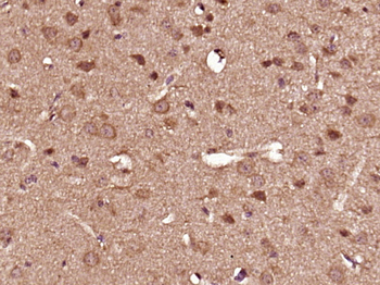 C-Kit/CD117 Rabbit Polyclonal Antibody