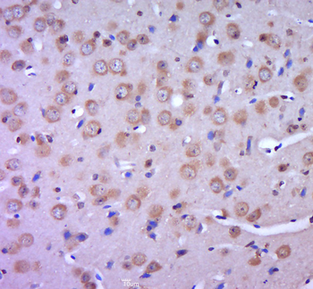 Leptin receptor Rabbit Polyclonal Antibody