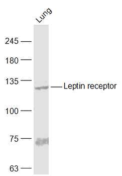 Leptin receptor Rabbit Polyclonal Antibody