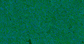 CD31 Mouse Monoclonal Antibody