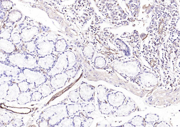 CD31 Mouse Monoclonal Antibody