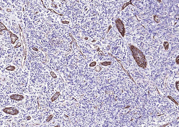 CD31 Mouse Monoclonal Antibody