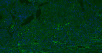 CD31 Mouse Monoclonal Antibody