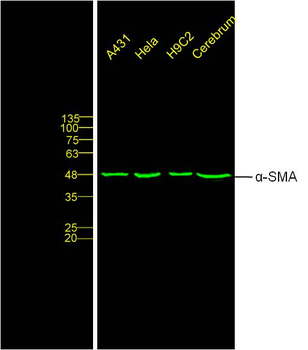 Alpha smooth muscle Actin Mouse Monoclonal Antibody
