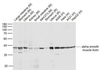 Alpha smooth muscle Actin Mouse Monoclonal Antibody