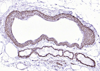 Alpha smooth muscle Actin Mouse Monoclonal Antibody