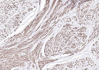 Alpha smooth muscle Actin Mouse Monoclonal Antibody