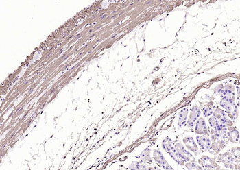 Alpha smooth muscle Actin Mouse Monoclonal Antibody