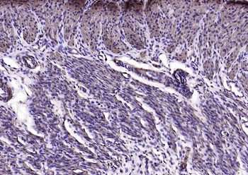 Alpha smooth muscle Actin Mouse Monoclonal Antibody