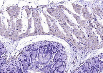 Alpha smooth muscle Actin Mouse Monoclonal Antibody